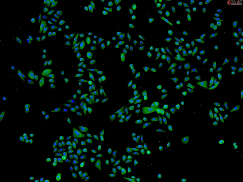 Human Epidermal Keratinocytes-fetal