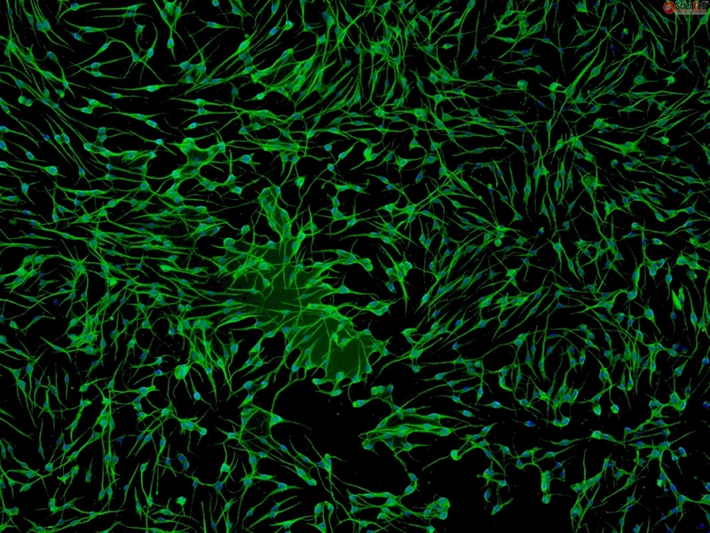 Human Epidermal Melanocytes-light