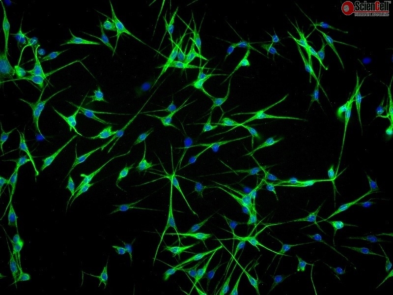 Human Epidermal Melanocytes-adult