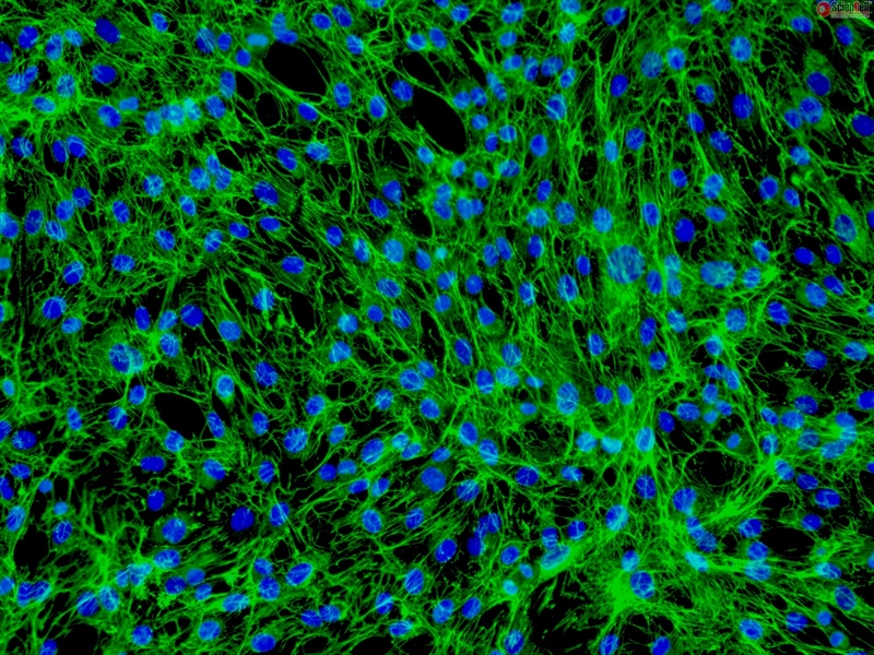 Human Dermal Fibroblasts-neonatal