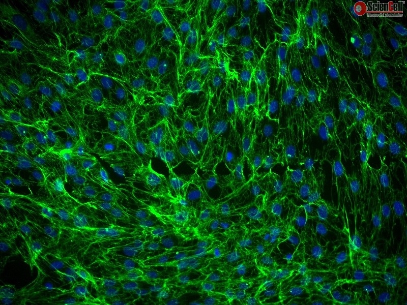 Human Dermal Fibroblasts-Fetal-Mitomycin C treated