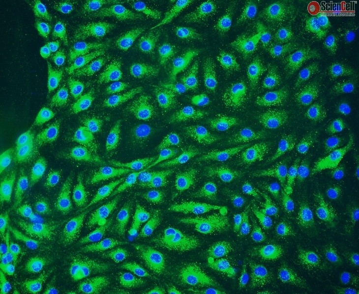 Human Primary Lymphatic Endothelial Cells, Passage 1, CD31+