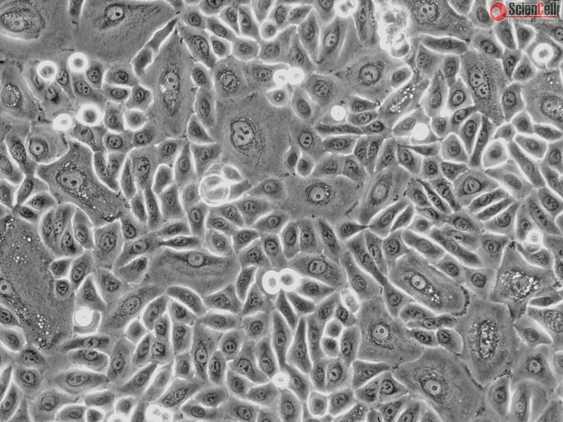 Human Tonsil Epithelial Cells, HTEpiC, Passage 1