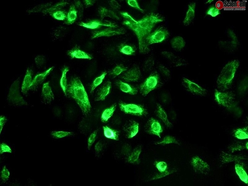 Human Oral Keratinocytes