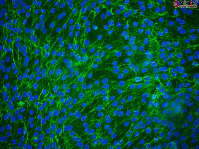 Cryopreserved Human Periodontal Ligament Fibroblasts, HPLF