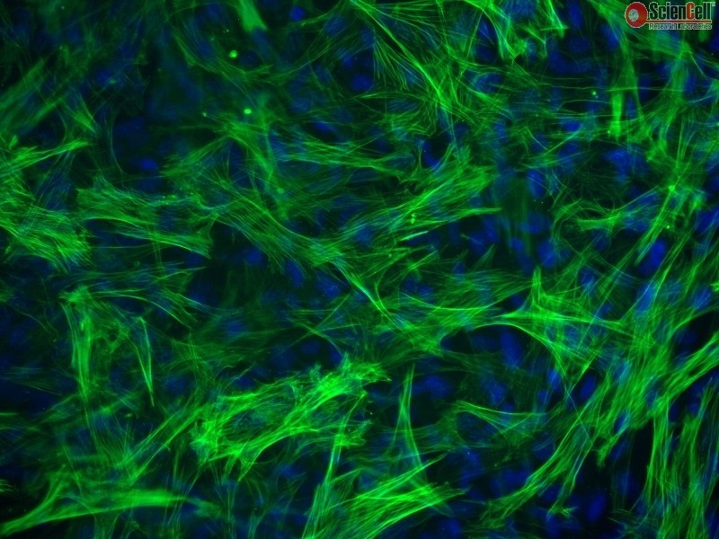 Human Esophageal Smooth Muscle Cells, Passage 1