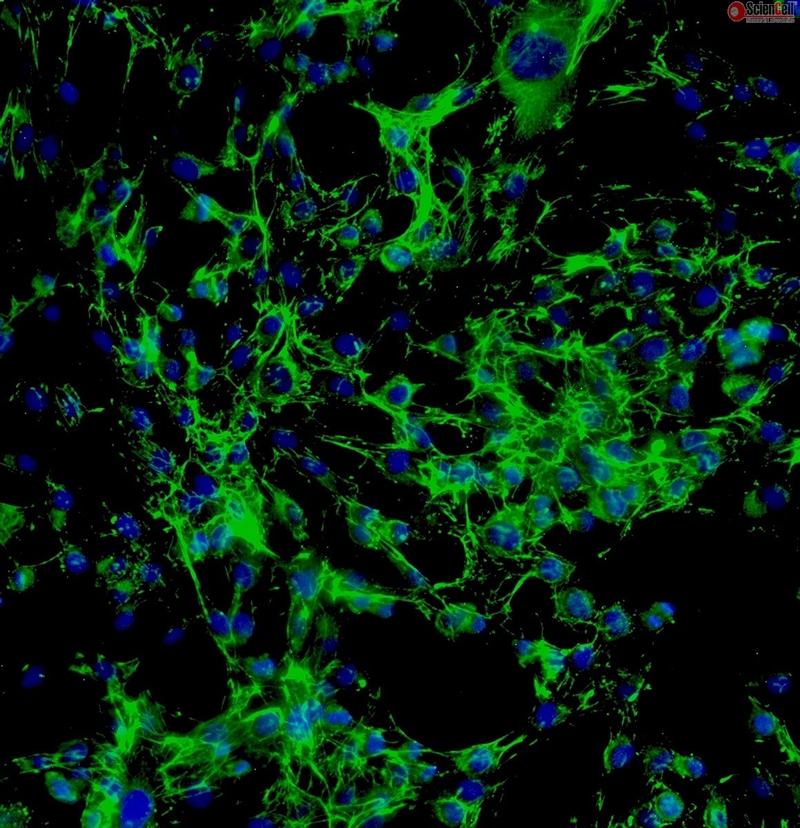 Human Esophageal Fibroblasts