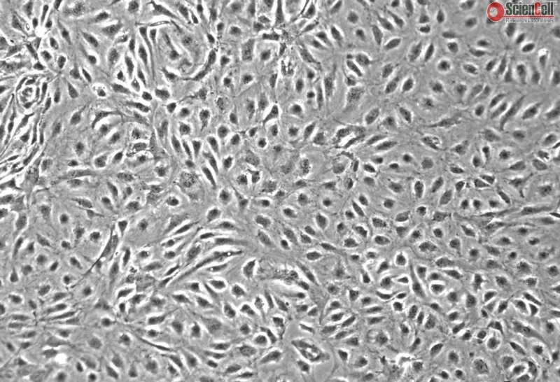 Human Intestinal Microvascular Endothelial Cells, Passage 1