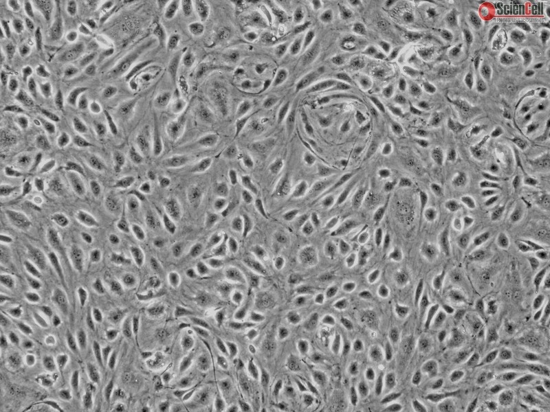 Human Colonic Microvascular Endothelial Cells, Passage 1