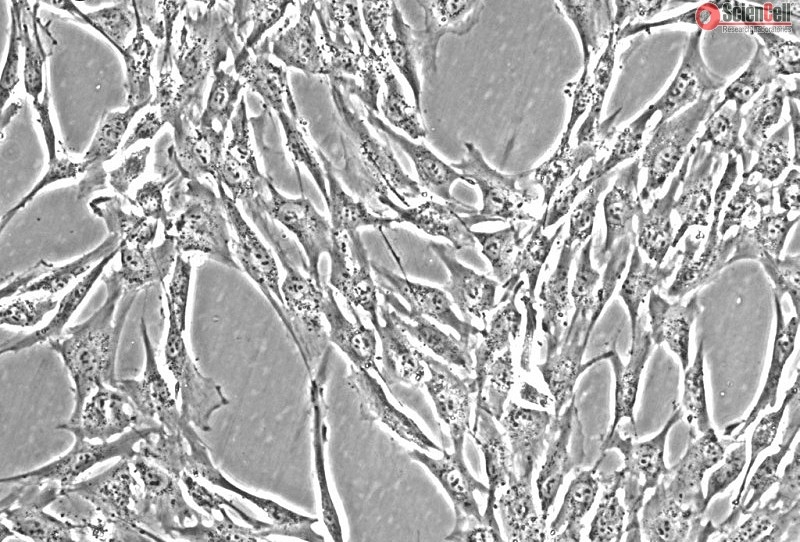 Human Colonic Smooth Muscle Cells, Passage 1