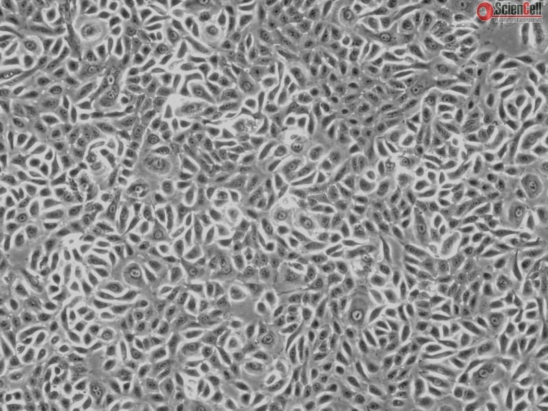 Human Primary Colonic Epithelial Cells (HCoEpiC), Passage 1