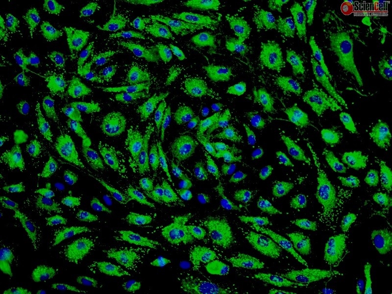 Human Pulmonary Microvascular Endothelial Cells HPMEC, Passage 1