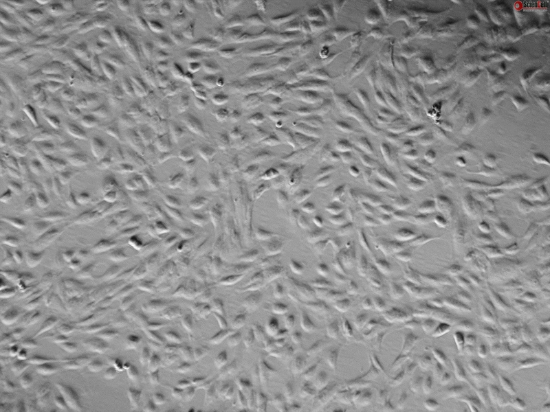 Human Pulmonary Artery Endothelial Cells, Passage 1