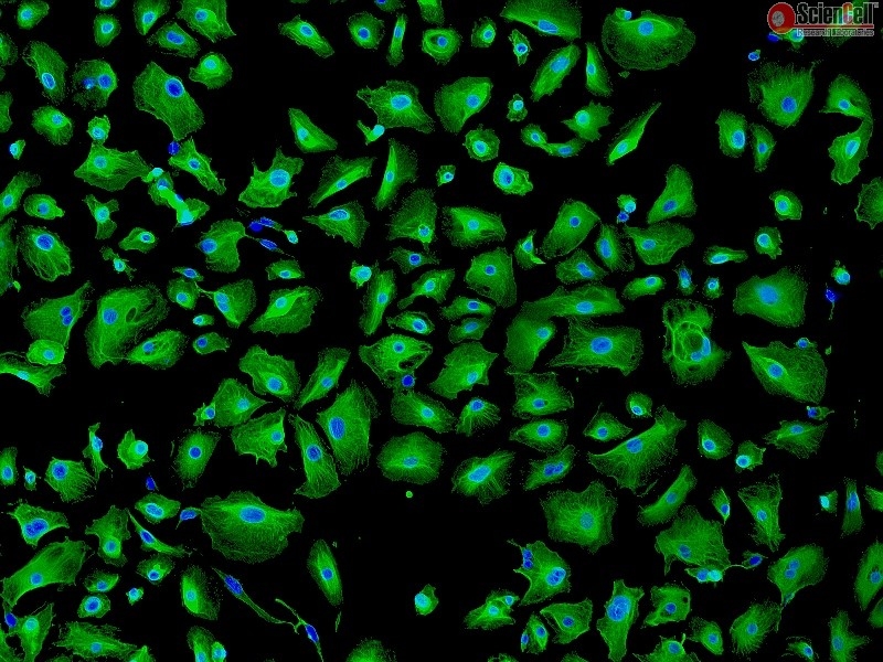 Human Pulmonary Alveolar Epithelial Cells, HPAEpiC, Passage 1