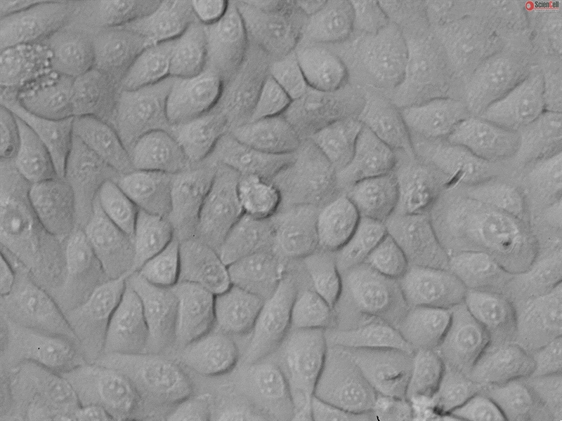Human Bronchial Epithelial Cells