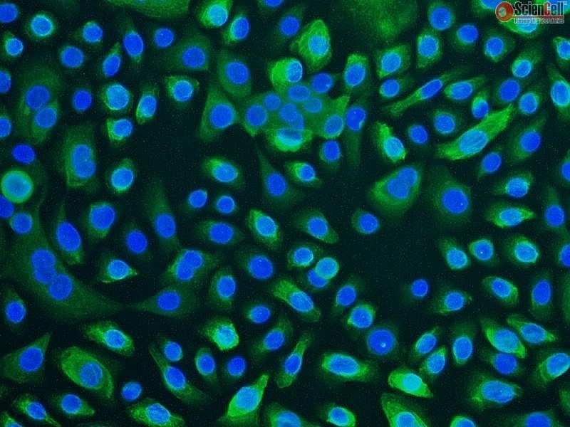 Human Tracheal Epithelial Cells, Passage 1