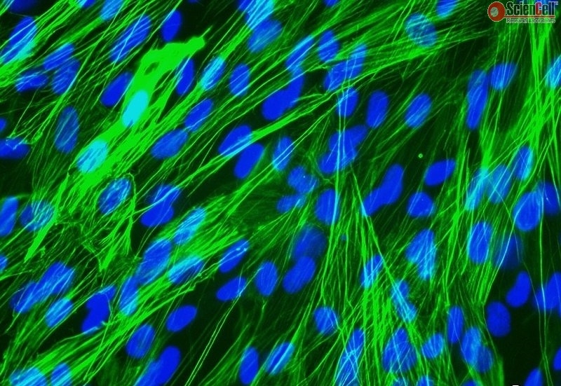 Human Bronchial Smooth Muscle Cells, Passage 1