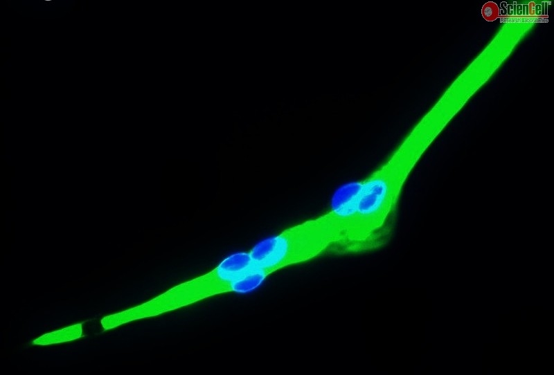 Human Skeletal Muscle Cells, Passage 1