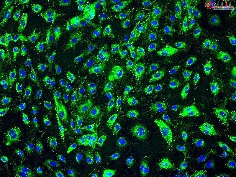 Human Adrenal Microvascular Endothelial Cells, Passage 1