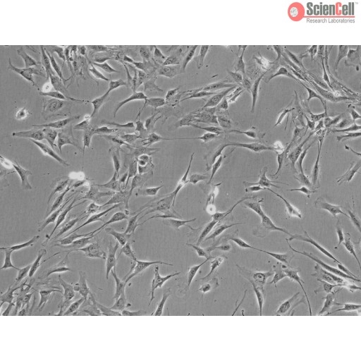 Human Adrenal Cortical Cells, Passage 1