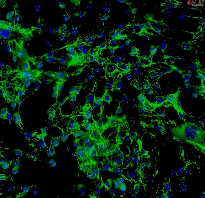 Human Thyroid Fibroblasts