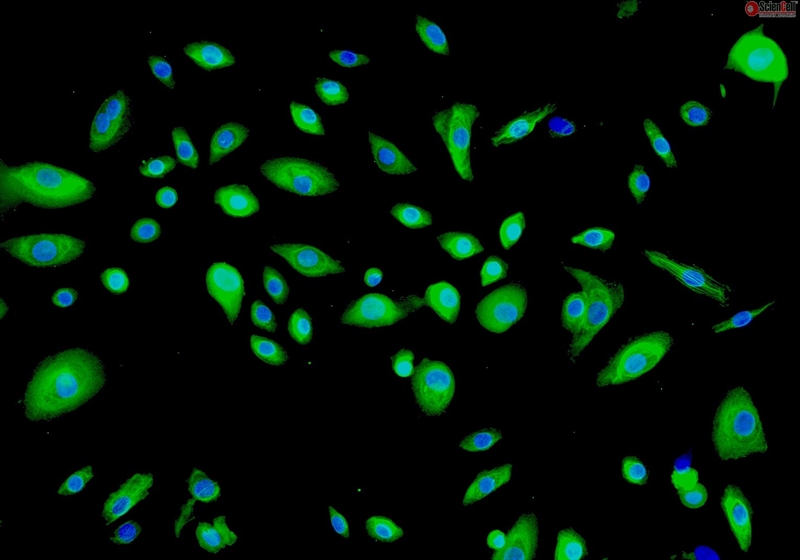 Human Thymic Epithelial Cells, Passage 1