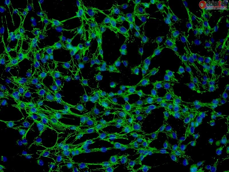 Human Thymic Fibroblasts