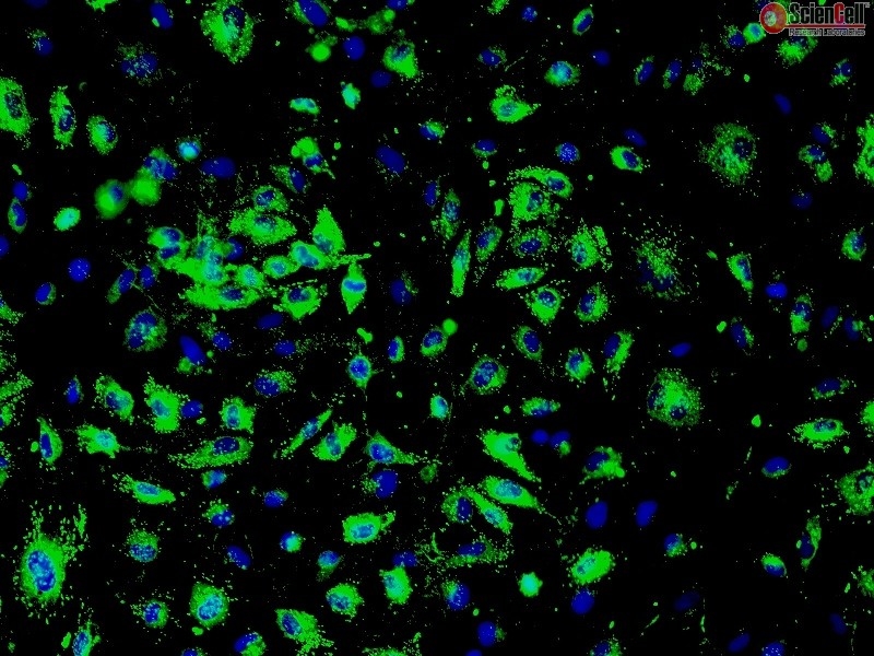 Human Primary Renal Glomerular Endothelial Cells, Passage 1, CD31+, vWF/Factor VIII+