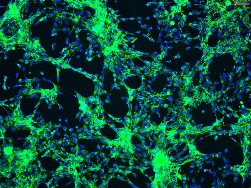 Human Renal Mesangial Cells, Passage 1