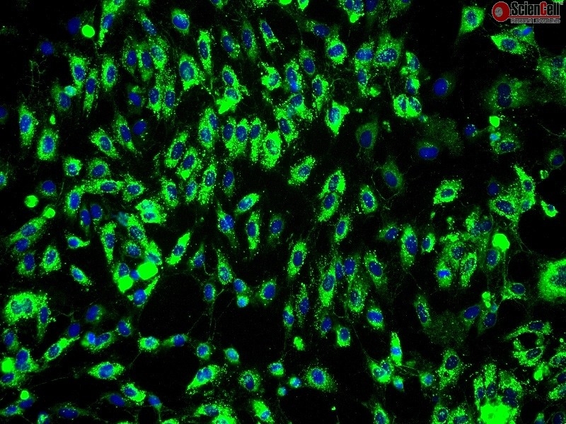 Human Bladder Microvascular Endothelial Cells, Passage 1