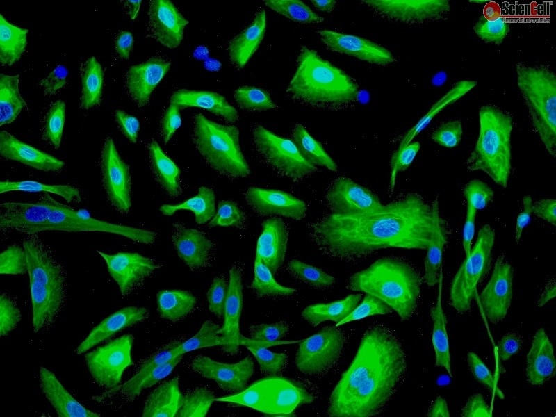 Human Urothelial Cells (HUC), Passage 1