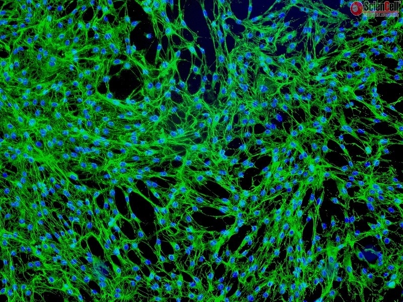 Human Prostate Fibroblasts