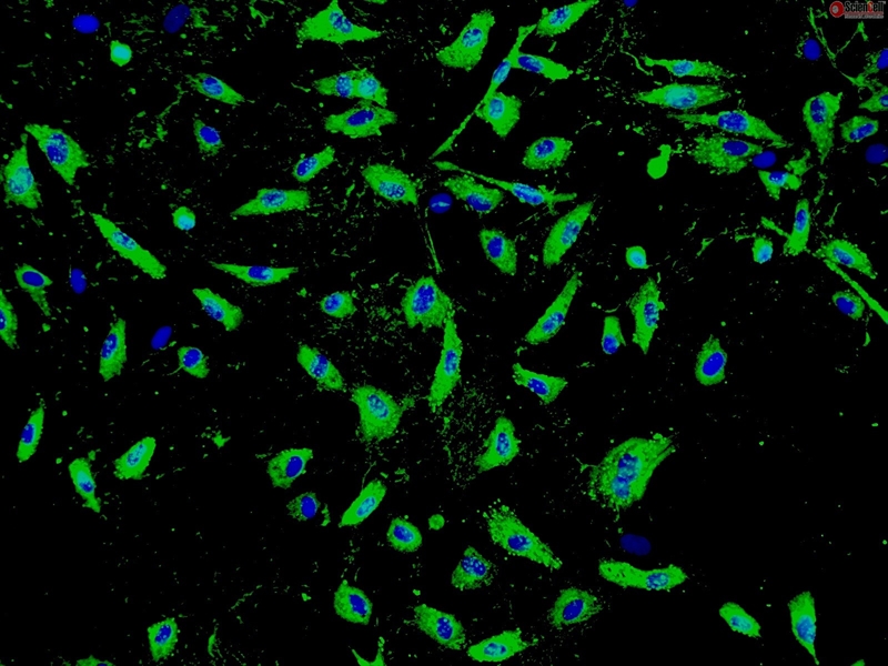 Human Seminal Vesicle Microvascular Endothelial Cells, Passage 1