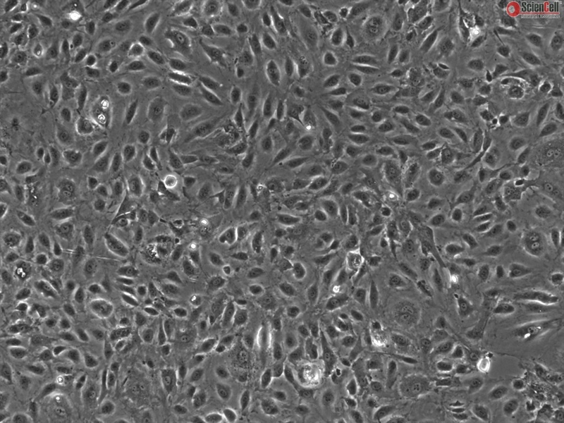 Human Testicular Endothelial Cells, Passage 1