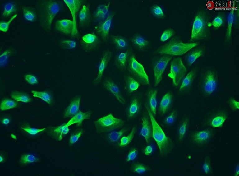 Human Leydig Cells (HLC), Passage 1