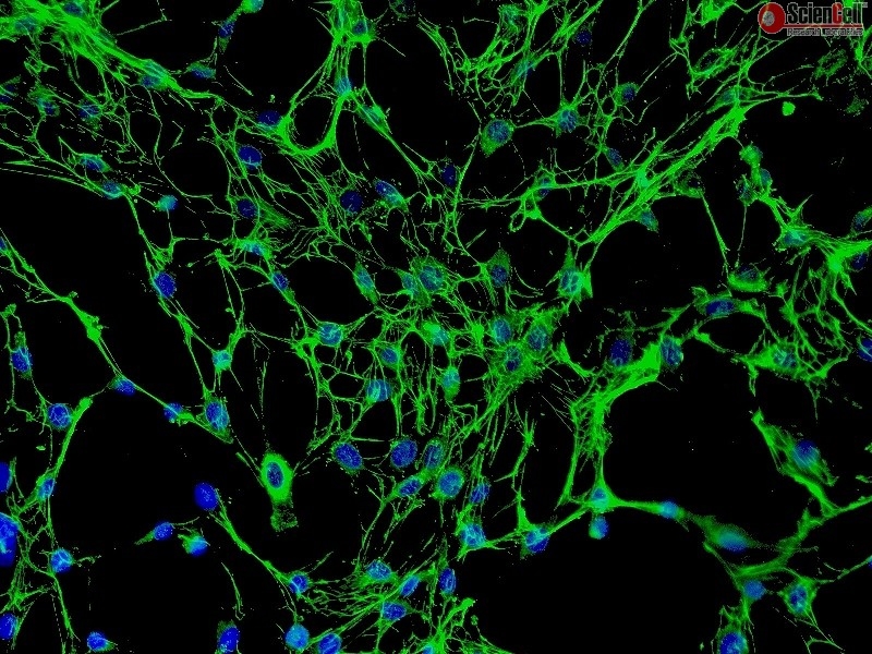 Human Osteoblasts-femoral