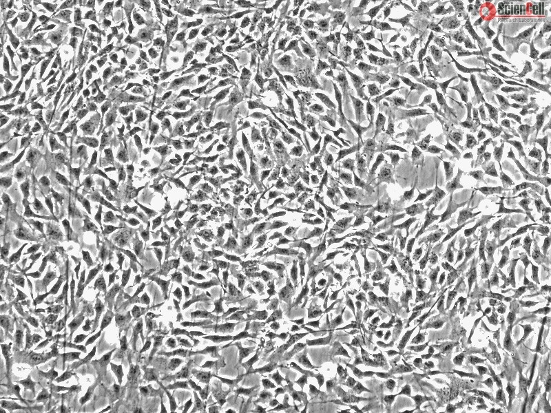 Human Chondrocytes-articular