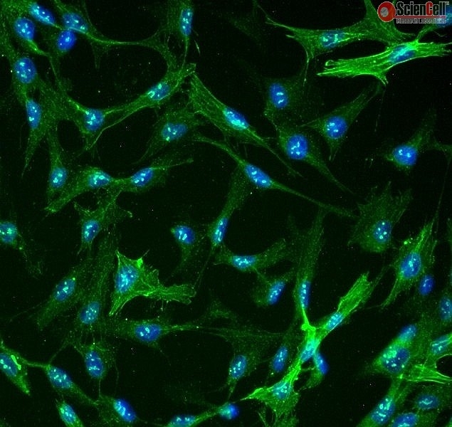 Human Hepatic Stellate Cells, Passage 1