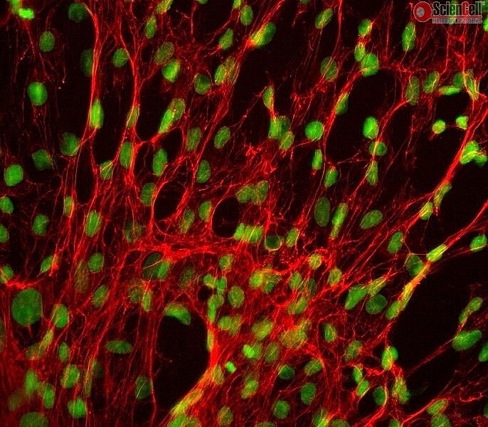 Human Splenic Fibroblasts