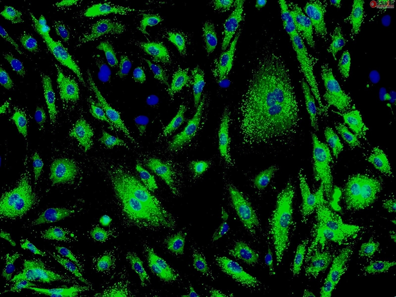 Human Cardiac Microvascular Endothelial Cells, Passage 1, vWF/Factor VIII and CD31 positive 