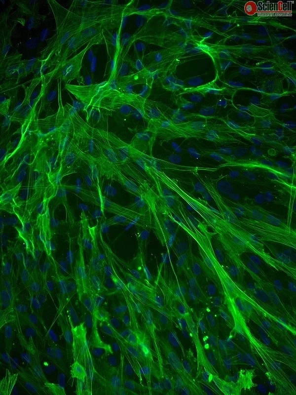 Human Aortic Smooth Muscle Cells, Passage 1