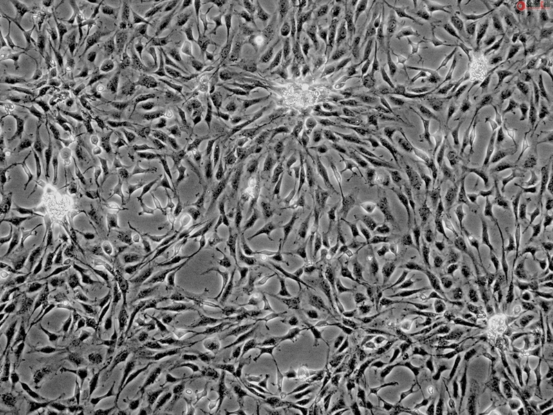 Human Cardiac Myocytes