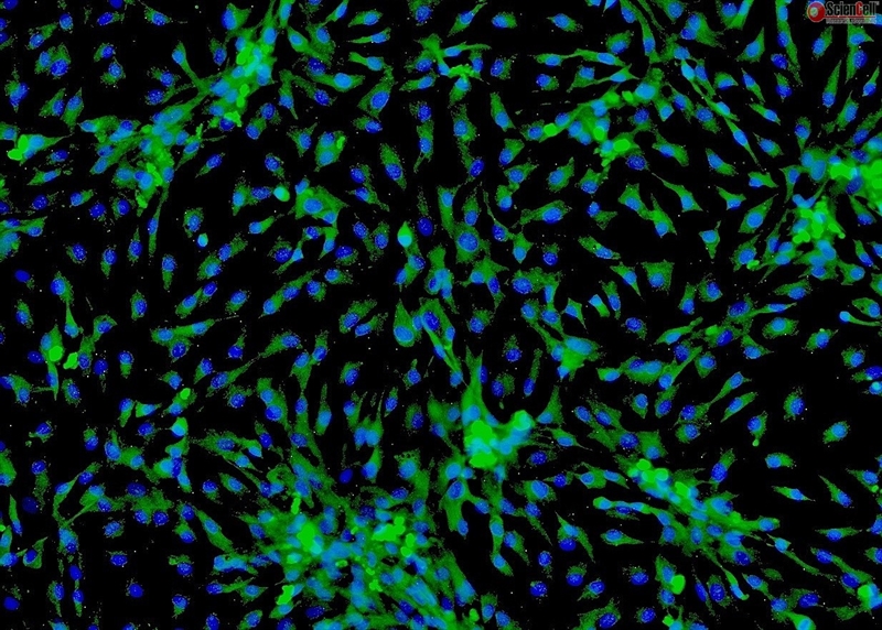 Human Cardiac Myocytes-adult