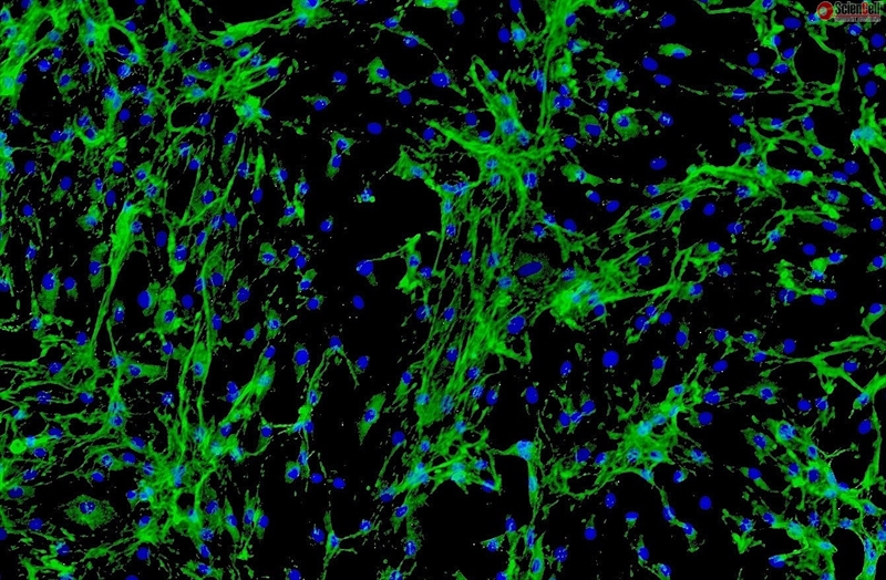 Human Cardiac Fibroblasts - Juvenile ventricular