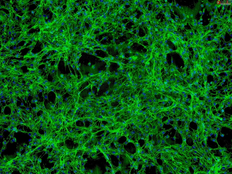 Human Pericardial Fibroblasts