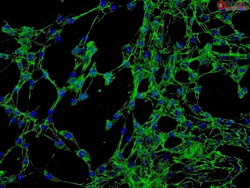 Human Conjunctival Fibroblasts