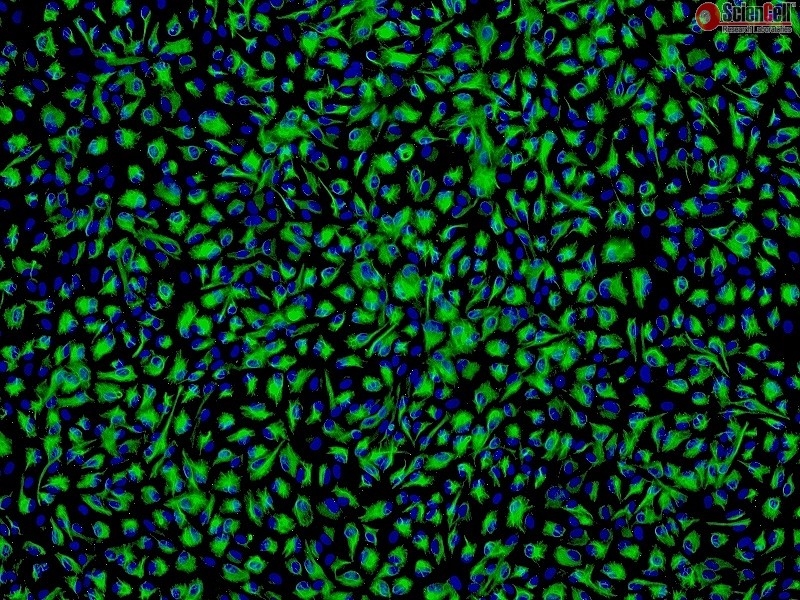 Human Non-Pigmented Ciliary Epithelial Cells, Passage 1