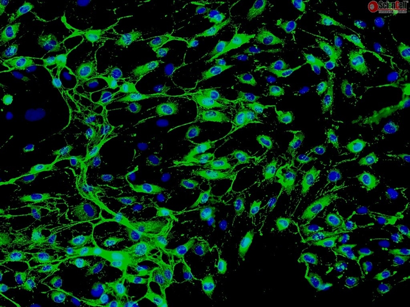 Human Myometrial Microvascular Endothelial Cells, Passage 1