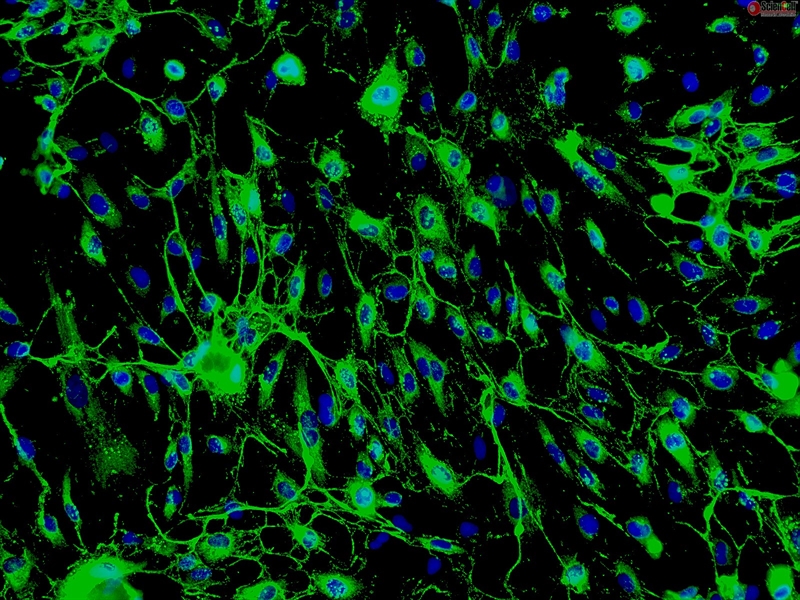 Human Endometrial Microvascular Endothelial Cells, Passage 1