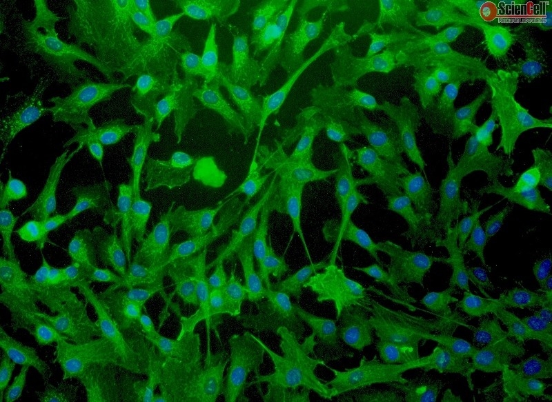 Human Myometrial Smooth Muscle Cells, Passage 1